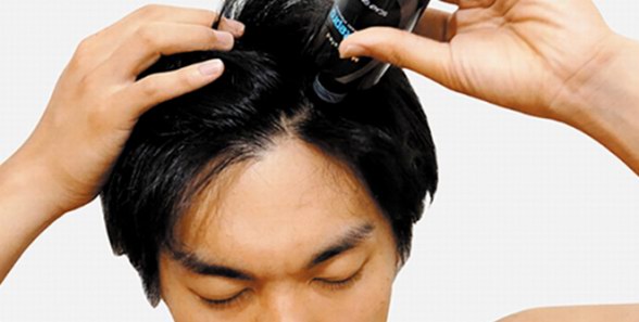 日本Aderans爱德兰丝药用头皮护理生发液——脱发人士的曙光
